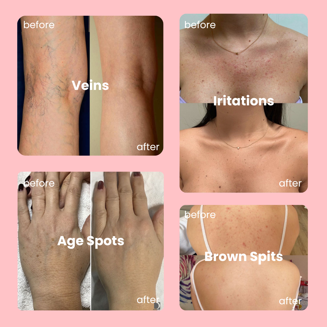 Nude BodyPerfector™